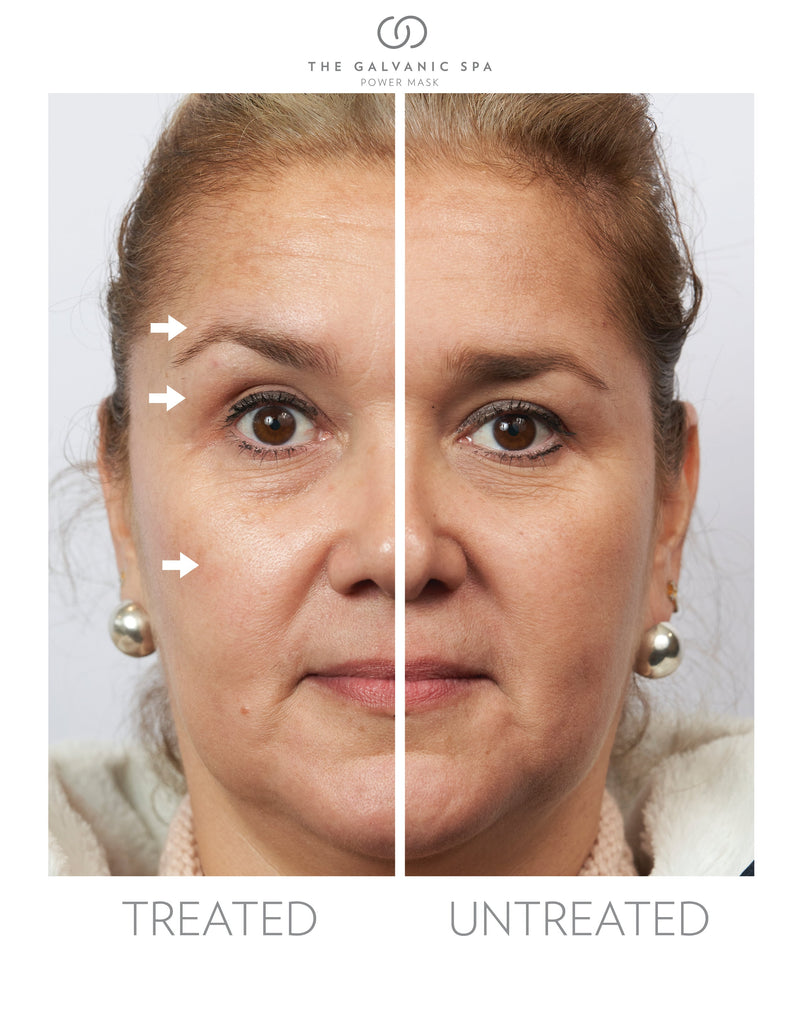 Galvanic vs. Microcurrent vs. LED: What Each Device Actually Does to Your Skin