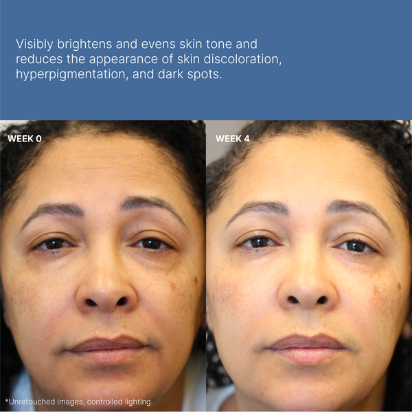Is Nu Skin Worth It? An Honest Review of Products and Results