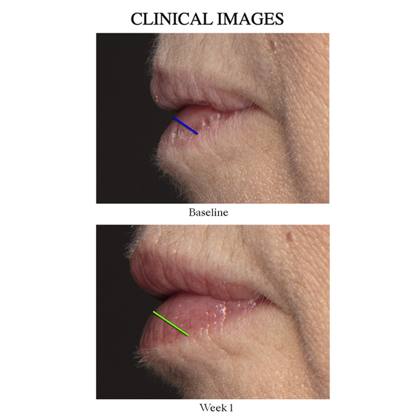 Clinical Image of Baseline Before and After 1 week